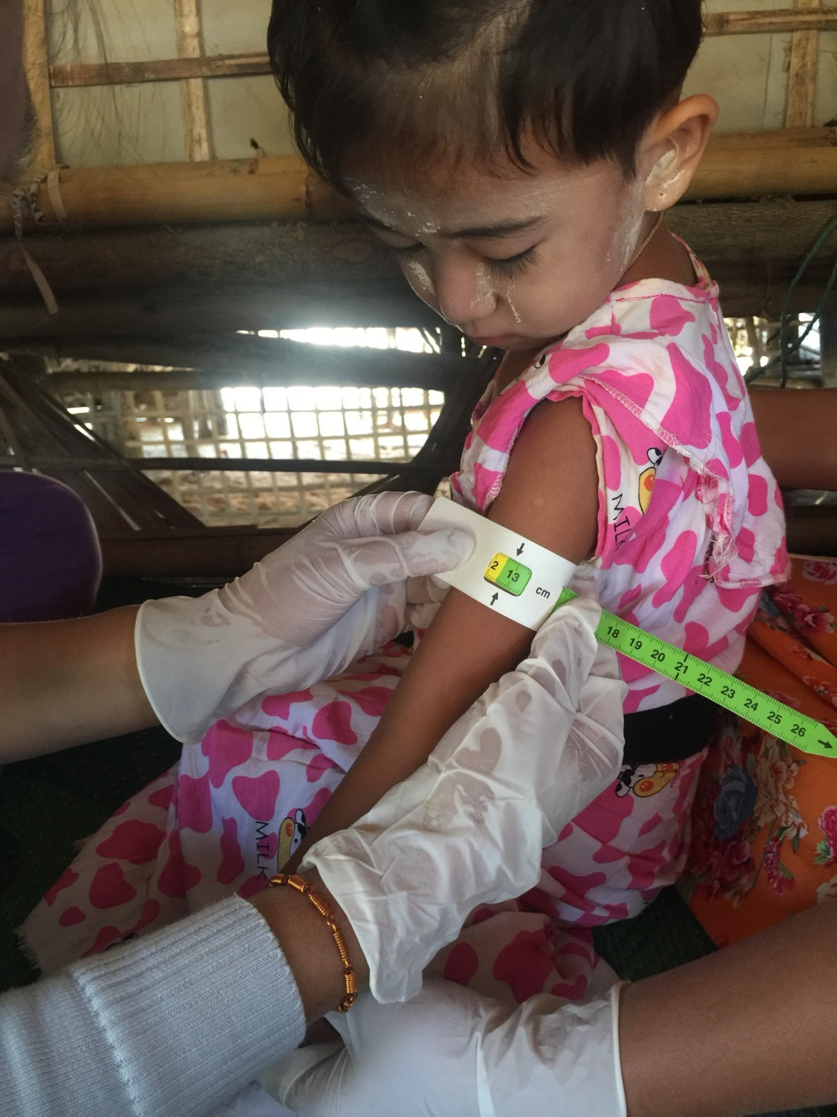 Supporting conflict-affected children suffering from malnutrition 